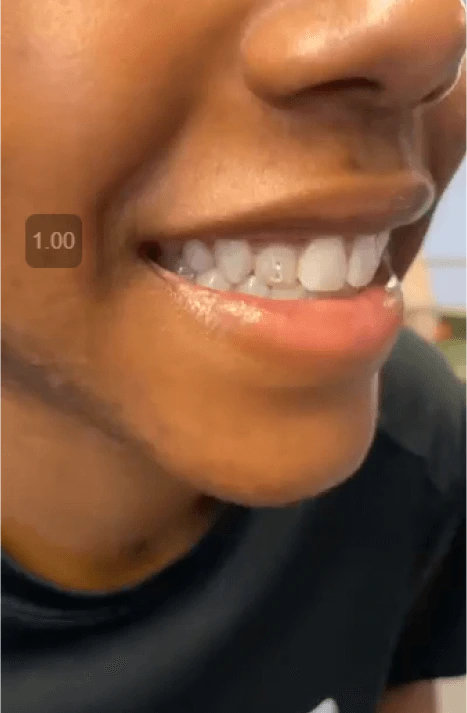 Smiling woman showing tooth gem