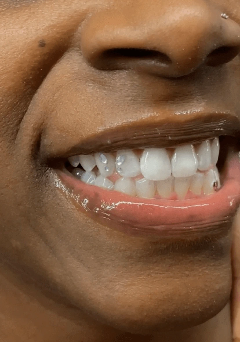 A smiling woman showcasing her decorated tooth